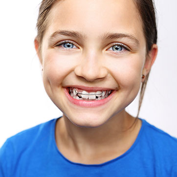 Types of Appliances - Braces Inc. | Silverdale Poulsbo WA